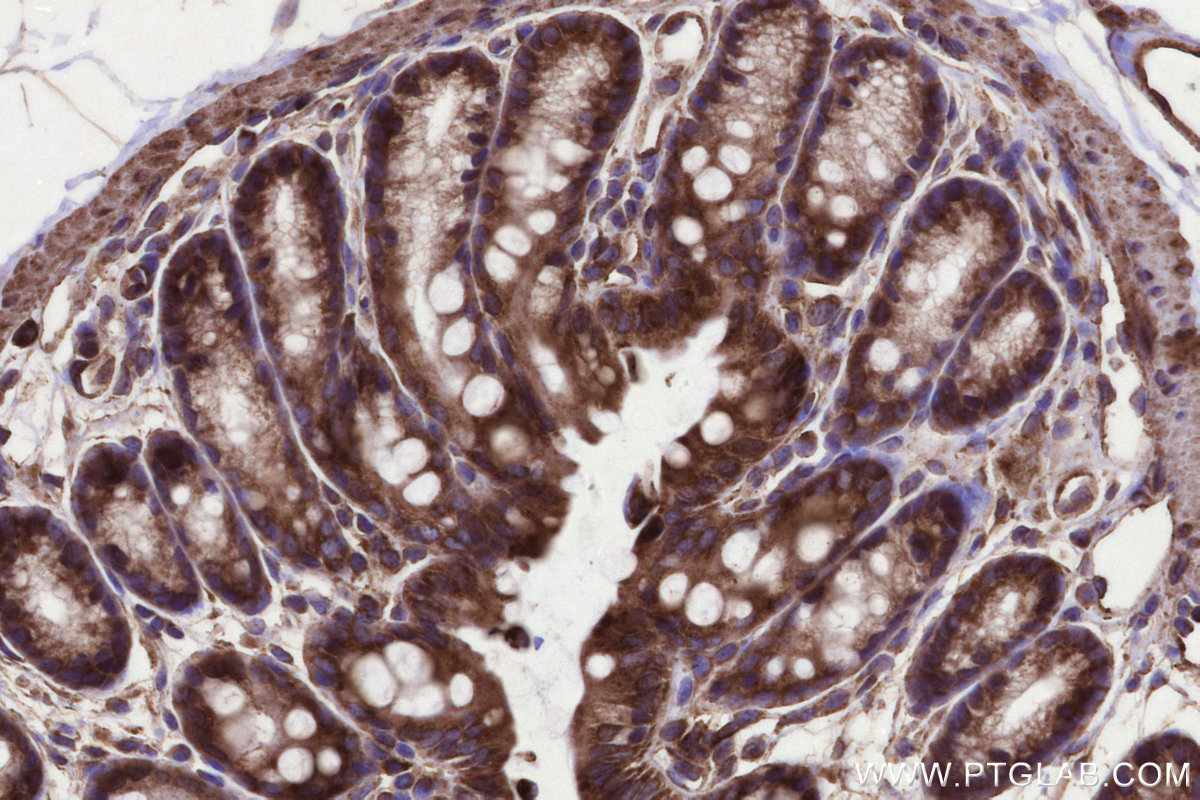 Immunohistochemical analysis of paraffin-embedded mouse colon tissue slide using KHC3289 (MMGT1 IHC Kit).