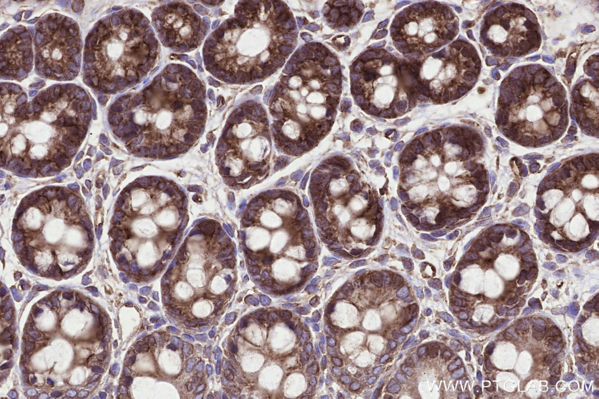 Immunohistochemical analysis of paraffin-embedded rat colon tissue slide using KHC3289 (MMGT1 IHC Kit).