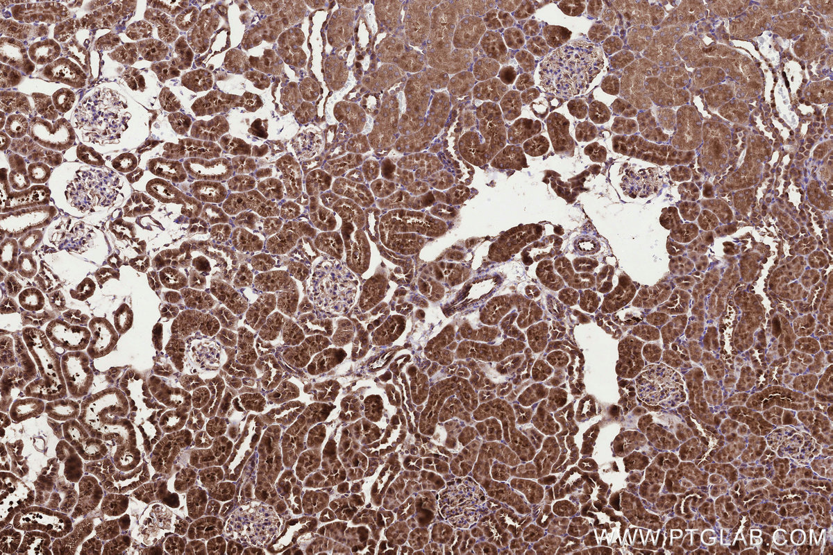 Immunohistochemical analysis of paraffin-embedded rat kidney tissue slide using KHC3289 (MMGT1 IHC Kit).
