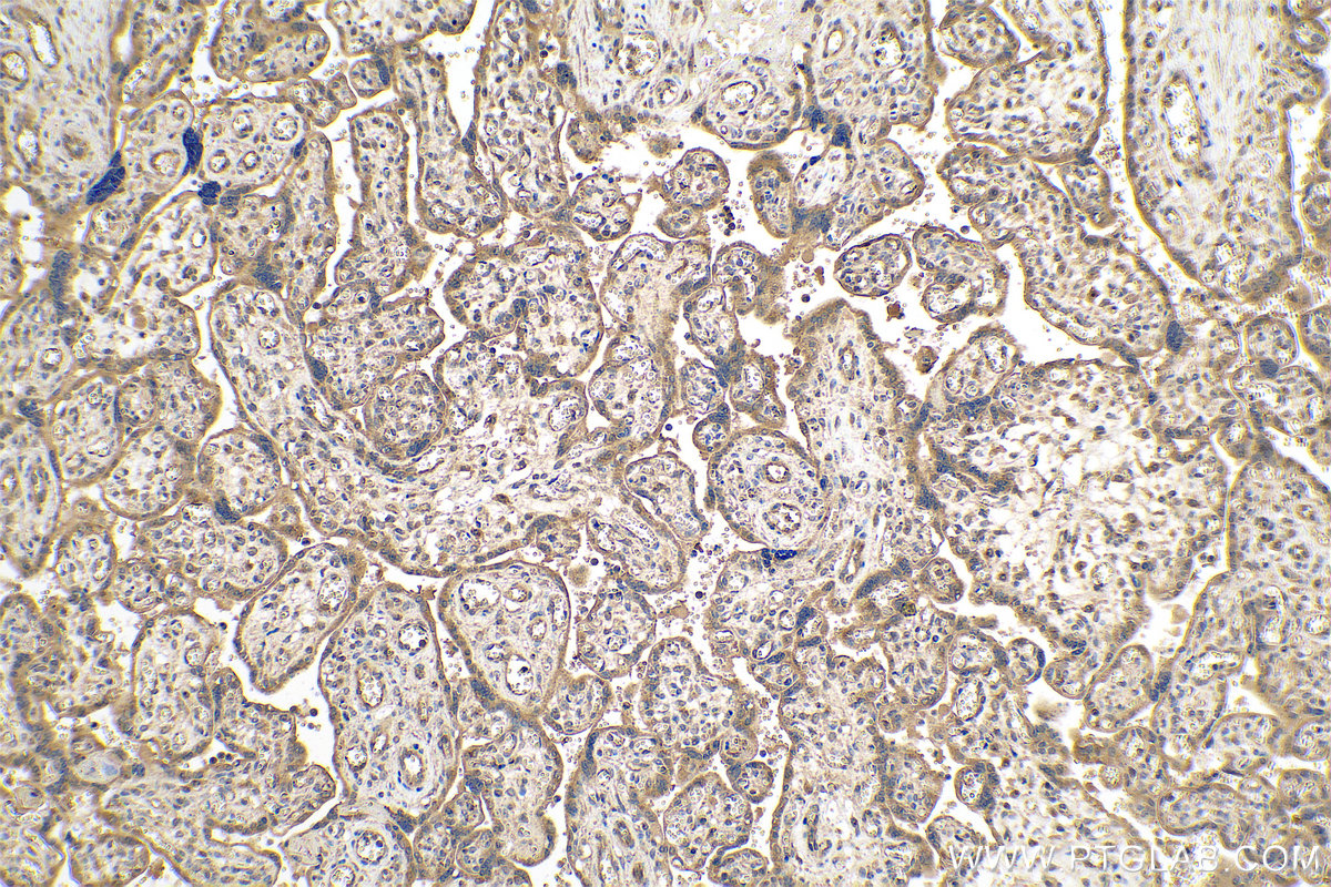 Immunohistochemical analysis of paraffin-embedded human placenta tissue slide using KHC0785 (MMP12 IHC Kit).