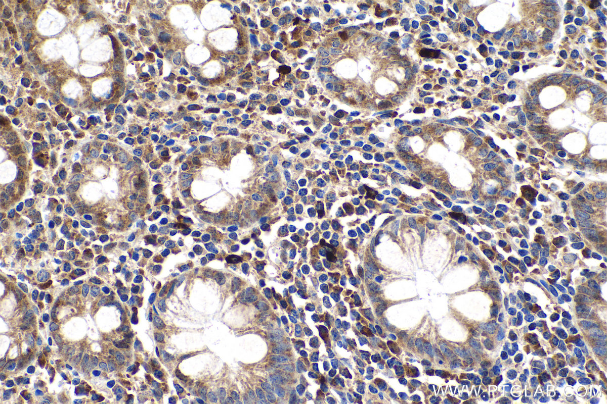 Immunohistochemical analysis of paraffin-embedded human colon tissue slide using KHC0762 (MMP2 IHC Kit).