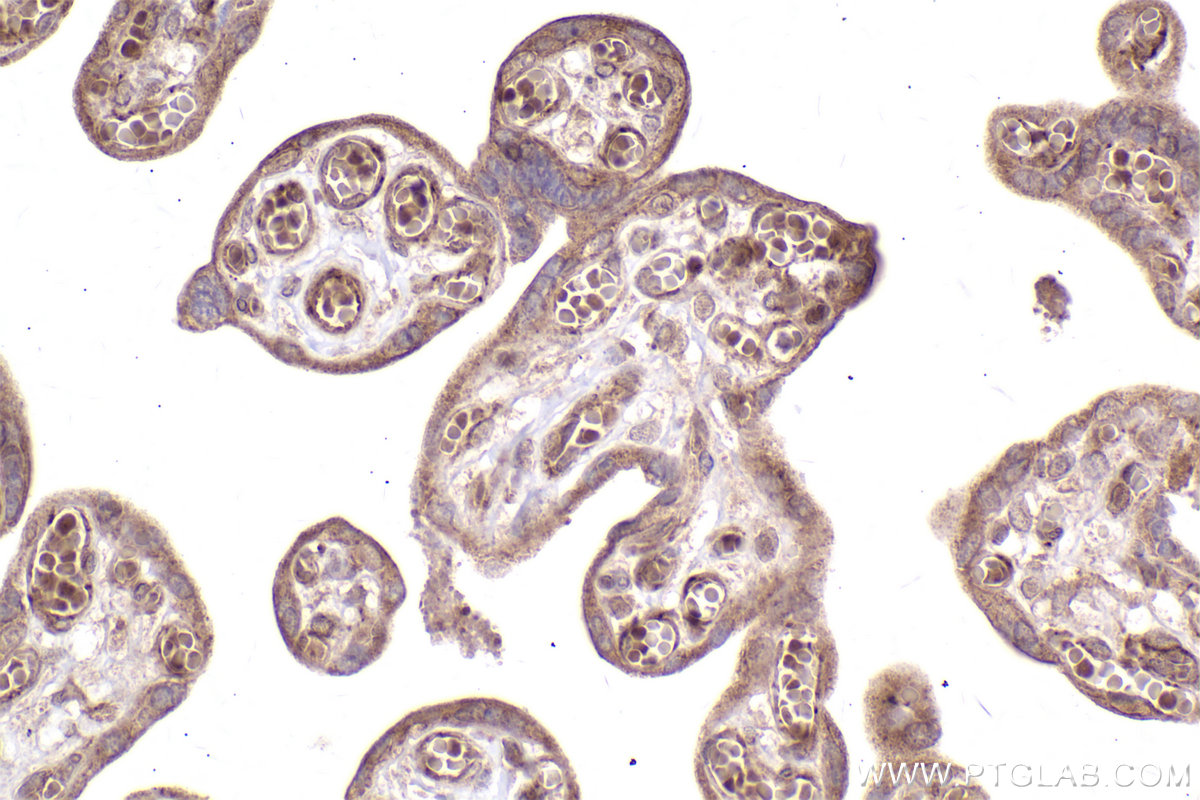 Immunohistochemical analysis of paraffin-embedded human placenta tissue slide using KHC2499 (MMS2 IHC Kit).