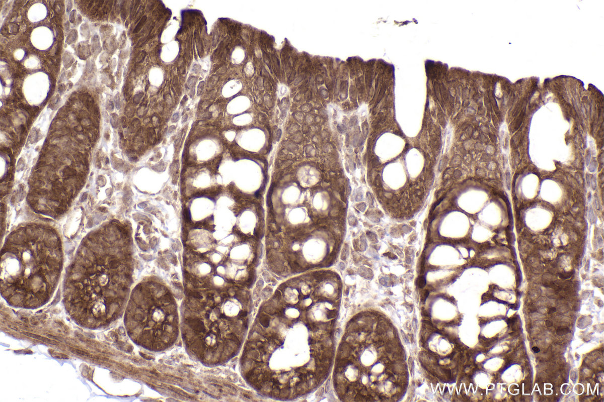 Immunohistochemical analysis of paraffin-embedded rat colon tissue slide using KHC2499 (MMS2 IHC Kit).
