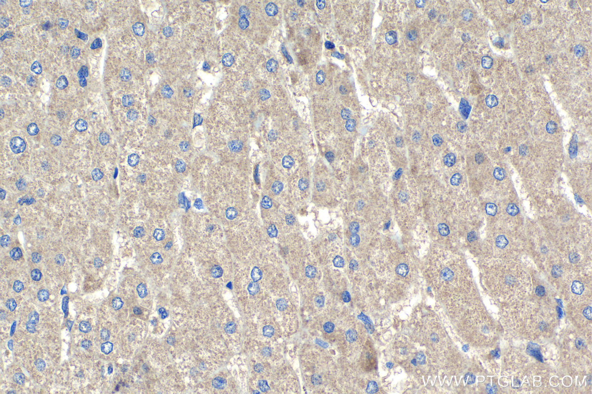 Immunohistochemical analysis of paraffin-embedded human liver tissue slide using KHC1401 (MOAP1 IHC Kit).