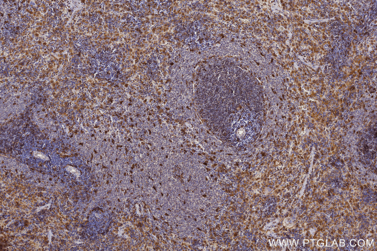 Immunohistochemical analysis of paraffin-embedded rat spleen tissue slide using KHC2700 (MOSPD2 IHC Kit).