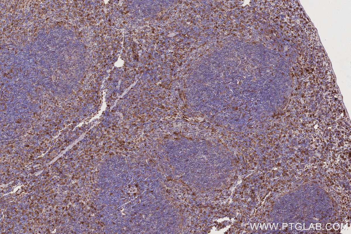 Immunohistochemical analysis of paraffin-embedded mouse spleen tissue slide using KHC2700 (MOSPD2 IHC Kit).