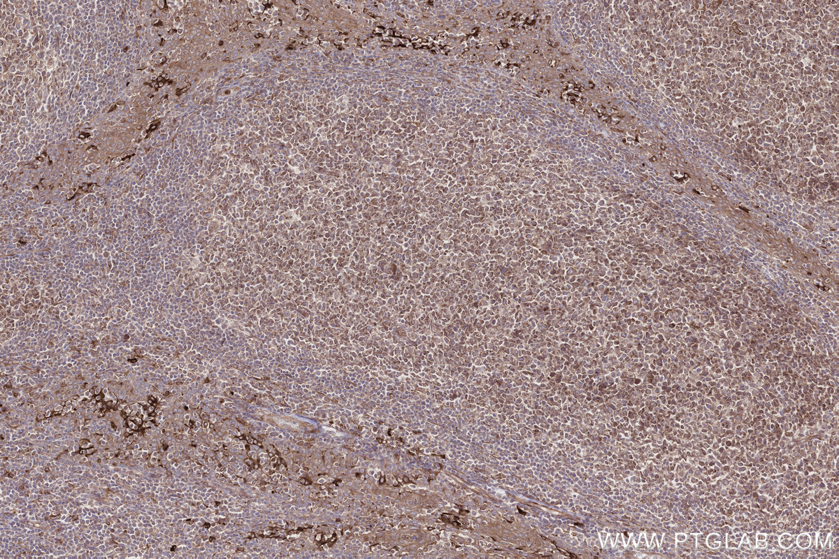 Immunohistochemical analysis of paraffin-embedded human tonsillitis tissue slide using KHC2700 (MOSPD2 IHC Kit).