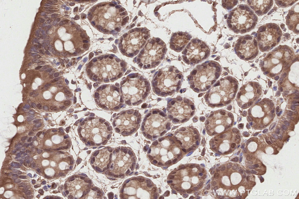 Immunohistochemical analysis of paraffin-embedded mouse colon tissue slide using KHC2841 (MPHOSPH6 IHC Kit).