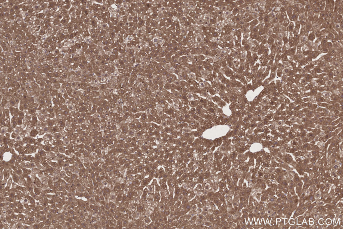 Immunohistochemical analysis of paraffin-embedded mouse liver tissue slide using KHC2706 (MPLKIP/TTDN1 IHC Kit).