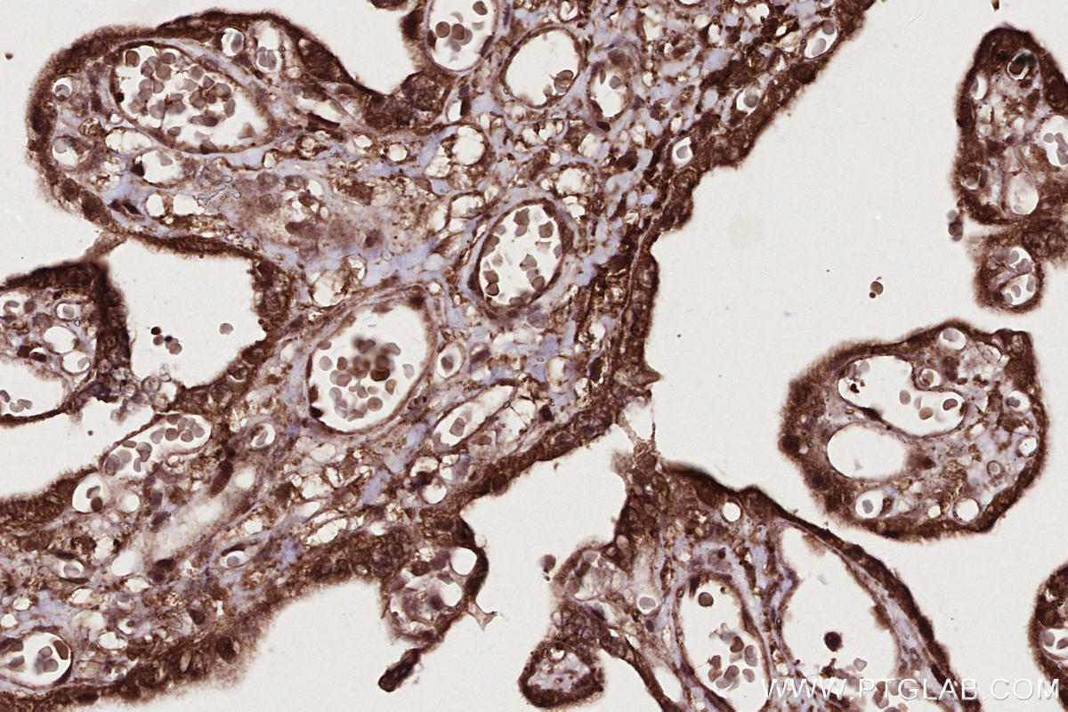 Immunohistochemical analysis of paraffin-embedded human placenta tissue slide using KHC2706 (MPLKIP/TTDN1 IHC Kit).