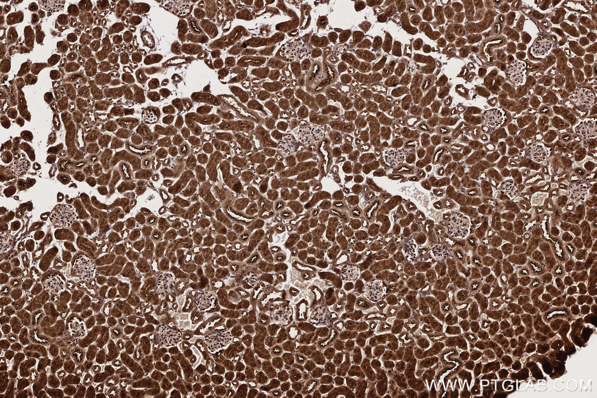 Immunohistochemical analysis of paraffin-embedded mouse kidney tissue slide using KHC2706 (MPLKIP/TTDN1 IHC Kit).
