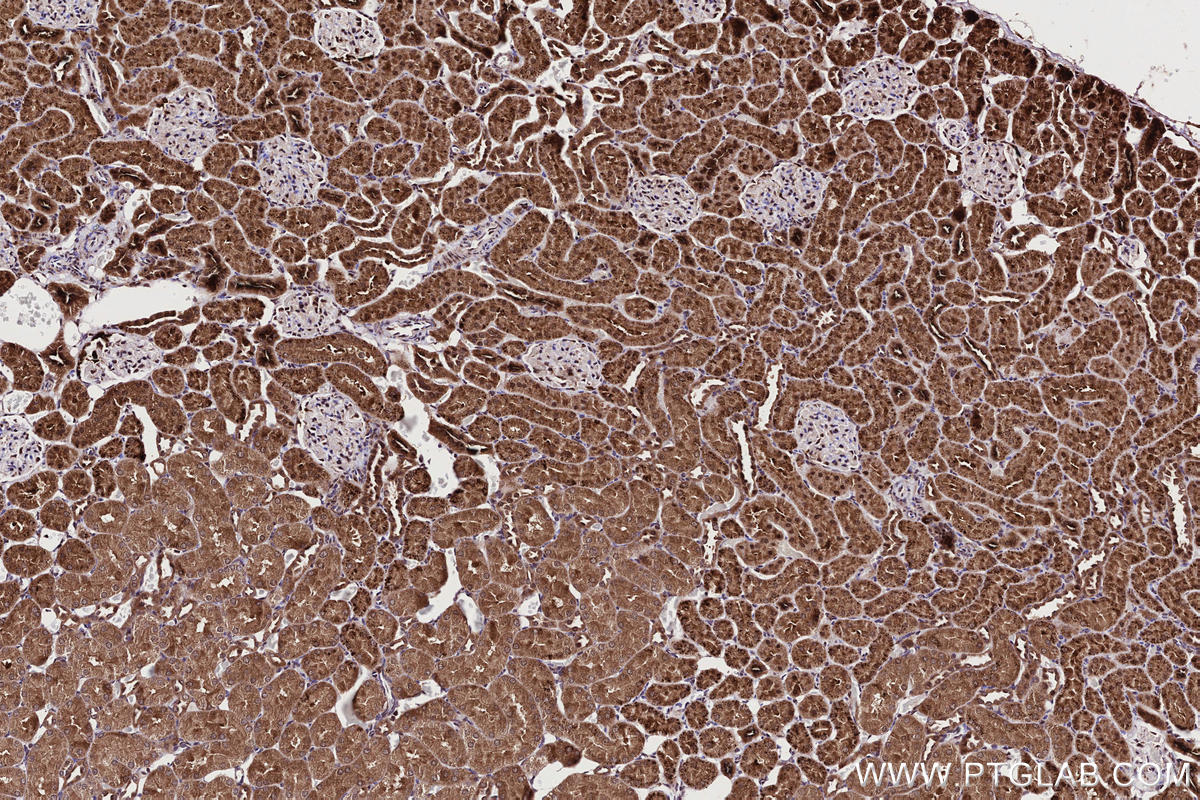Immunohistochemical analysis of paraffin-embedded rat kidney tissue slide using KHC2706 (MPLKIP/TTDN1 IHC Kit).