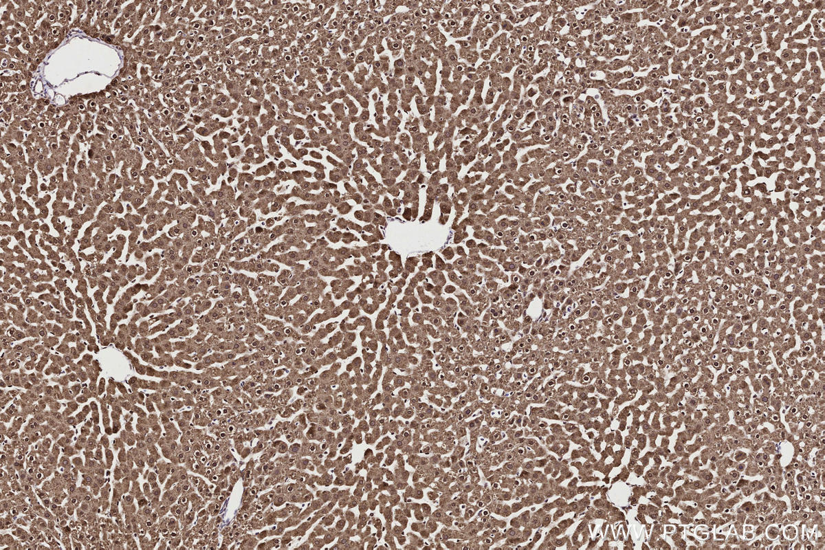 Immunohistochemical analysis of paraffin-embedded rat liver tissue slide using KHC2706 (MPLKIP/TTDN1 IHC Kit).
