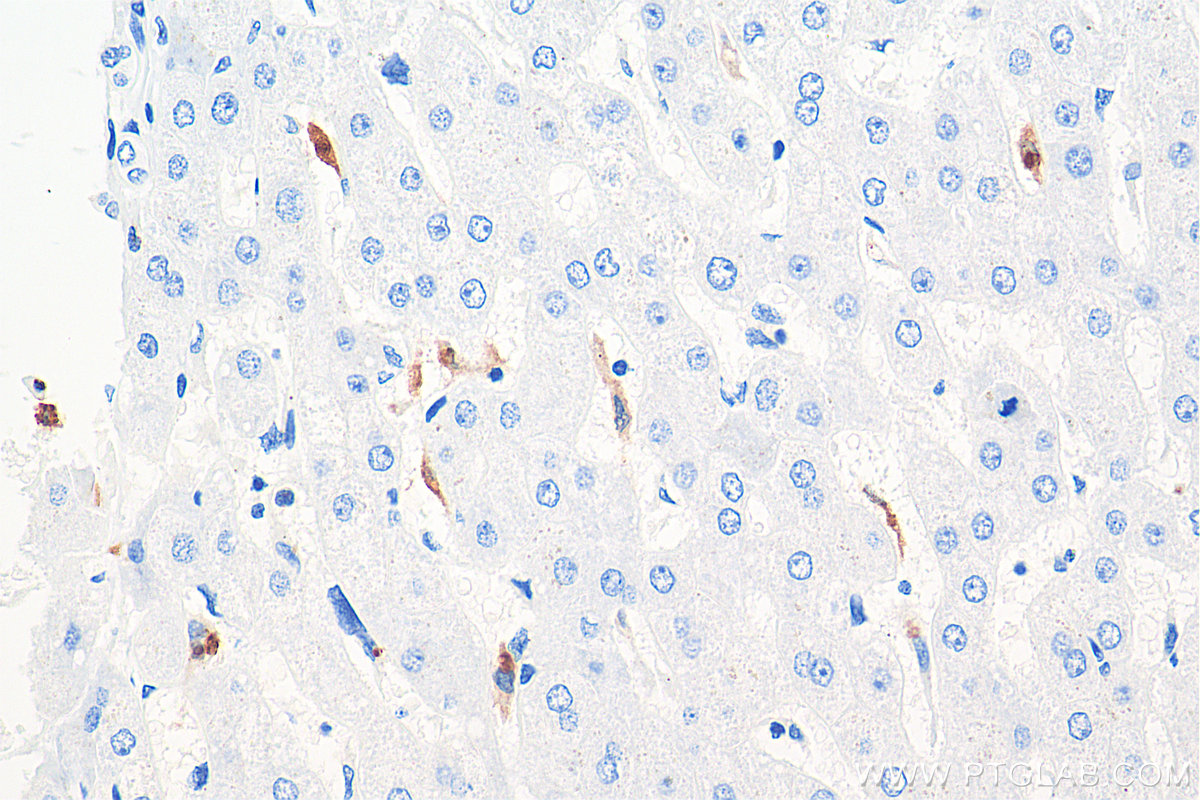 Immunohistochemical analysis of paraffin-embedded human liver tissue slide using KHC0040 (MPO IHC Kit).