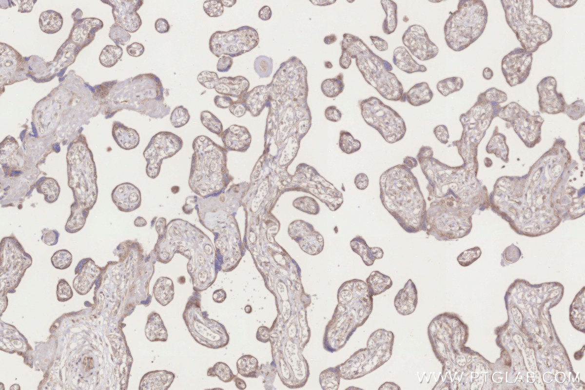 Immunohistochemical analysis of paraffin-embedded human placenta tissue slide using KHC3280 (MRPL10 IHC Kit).