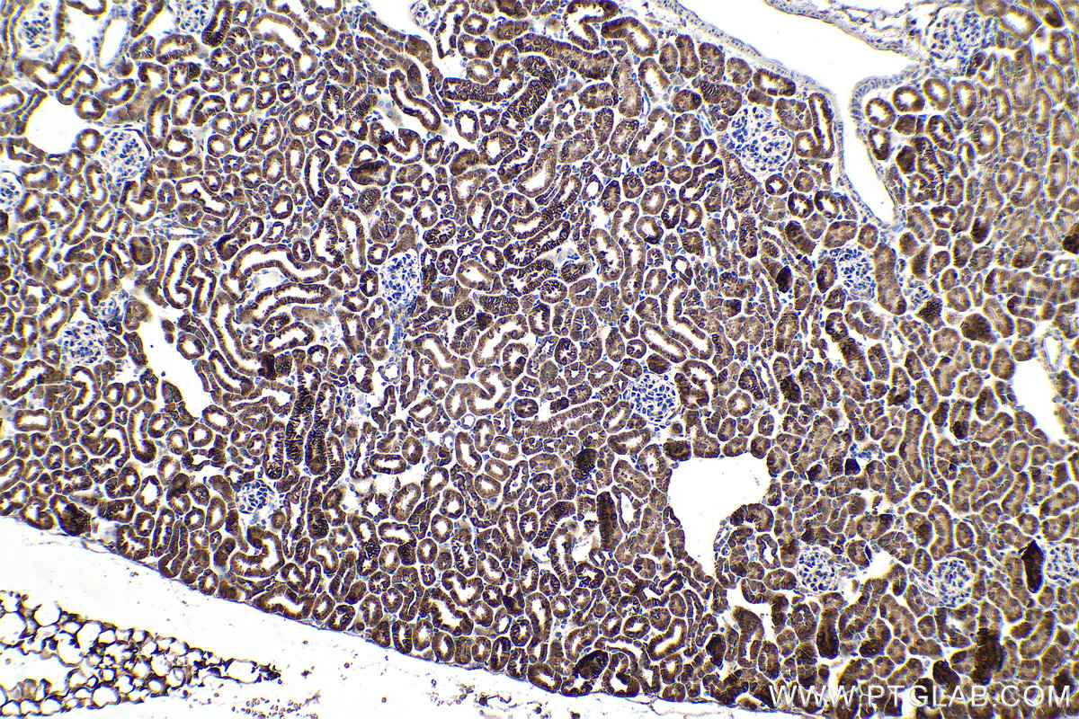 Immunohistochemical analysis of paraffin-embedded mouse kidney tissue slide using KHC0893 (MRPL12 IHC Kit).