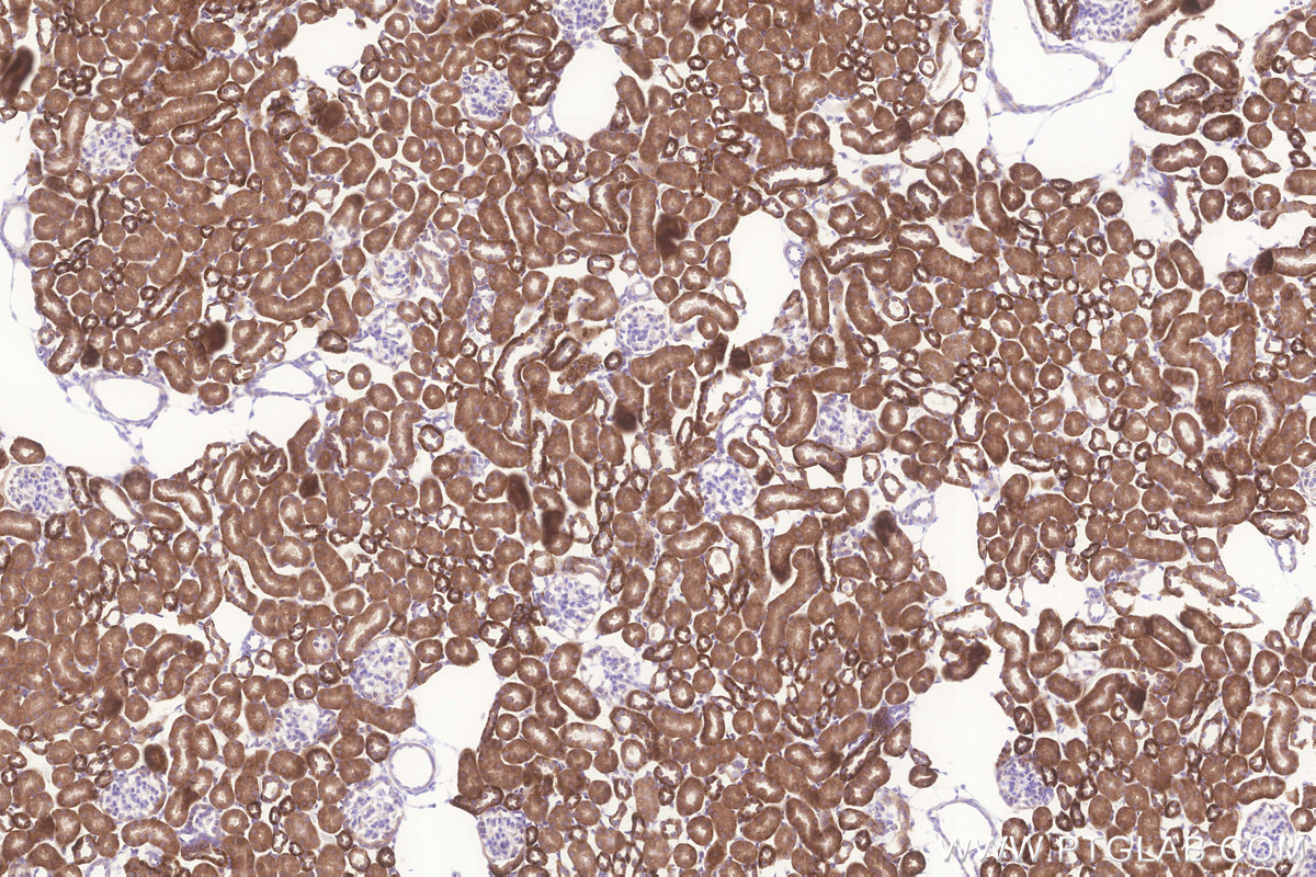 Immunohistochemical analysis of paraffin-embedded mouse kidney tissue slide using KHC3256 (MRPL23 IHC Kit).