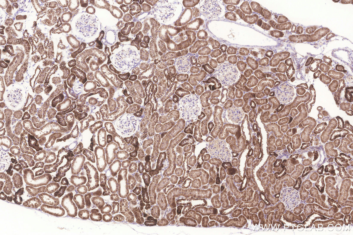 Immunohistochemical analysis of paraffin-embedded rat kidney tissue slide using KHC3256 (MRPL23 IHC Kit).