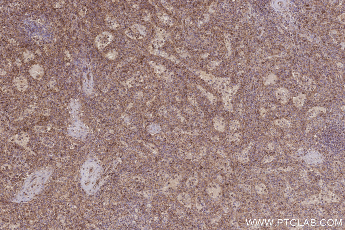 Immunohistochemical analysis of paraffin-embedded human spleen tissue slide using KHC3249 (MRPL28 IHC Kit).