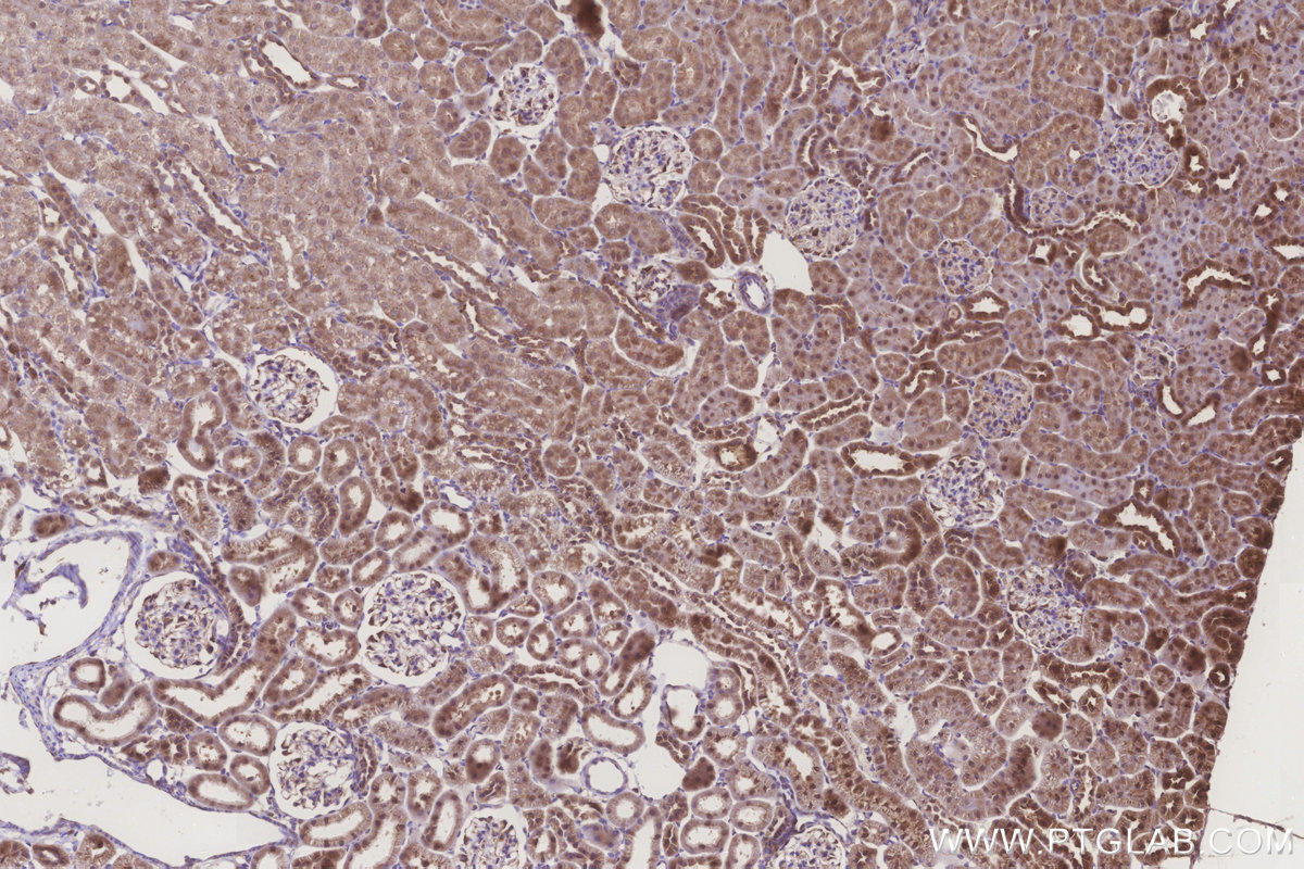 Immunohistochemical analysis of paraffin-embedded rat kidney tissue slide using KHC3249 (MRPL28 IHC Kit).