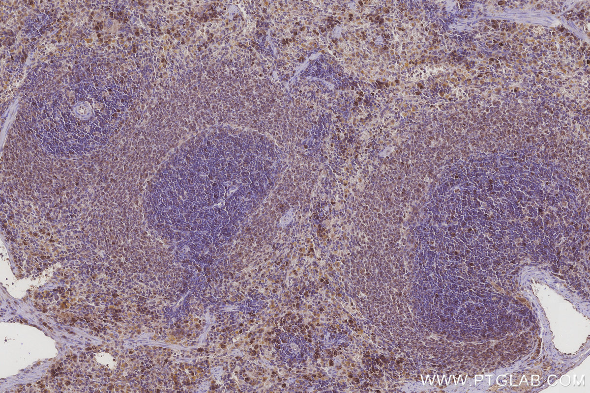 Immunohistochemical analysis of paraffin-embedded rat spleen tissue slide using KHC3249 (MRPL28 IHC Kit).