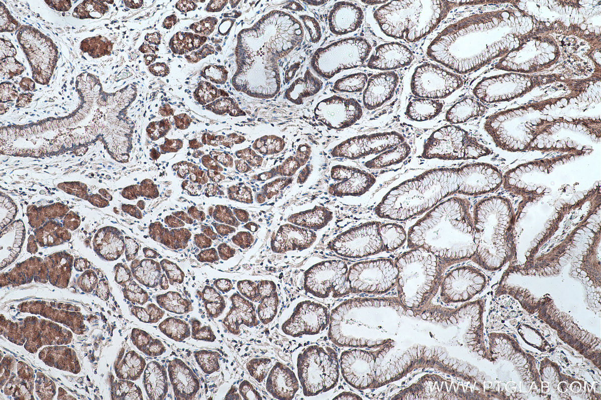 Immunohistochemical analysis of paraffin-embedded human stomach cancer(NAT) tissue slide using KHC0436 (MRPL33 IHC Kit).