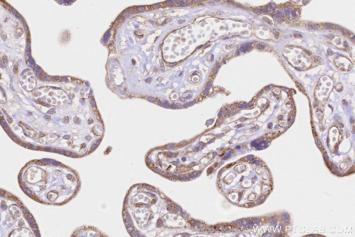 Immunohistochemical analysis of paraffin-embedded human placenta tissue slide using KHC3239 (MRPS22 IHC Kit).
