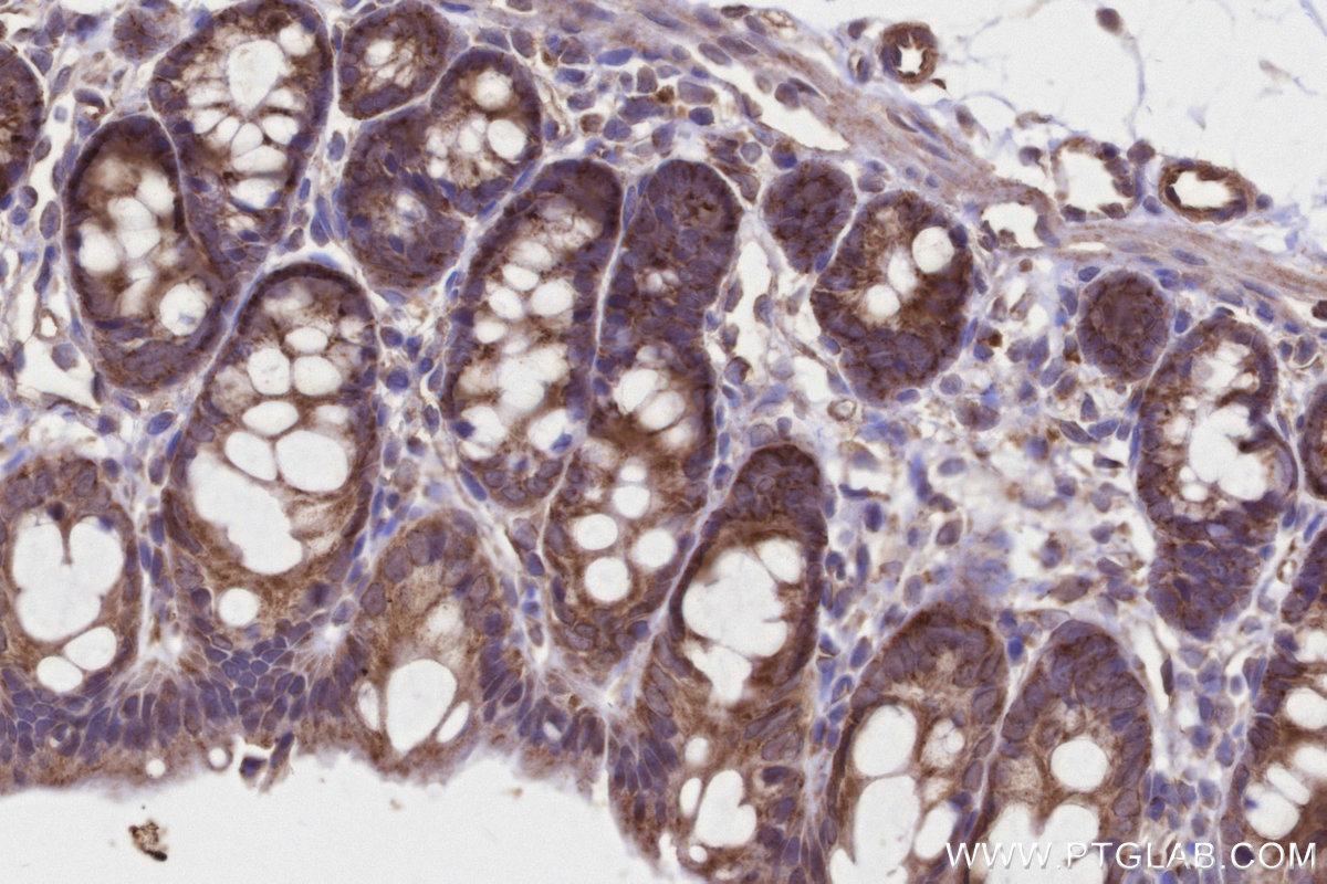 Immunohistochemical analysis of paraffin-embedded rat colon tissue slide using KHC3239 (MRPS22 IHC Kit).