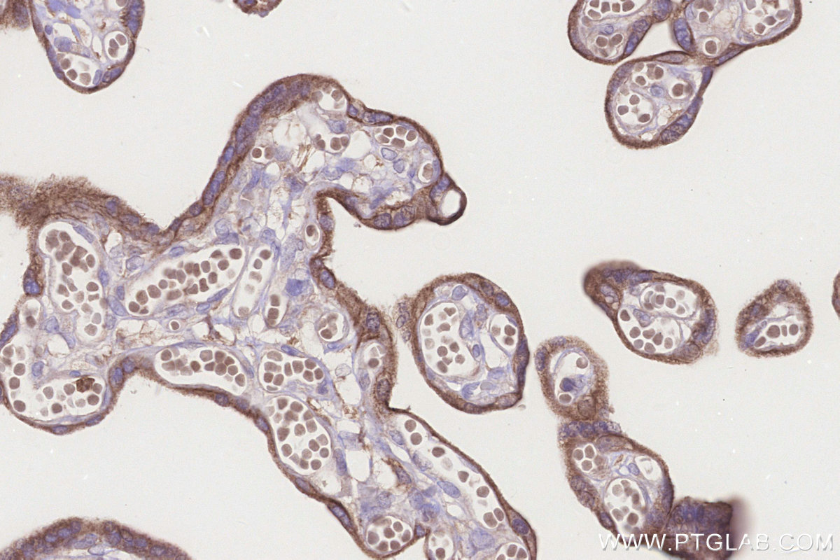 Immunohistochemical analysis of paraffin-embedded human placenta tissue slide using KHC3305 (MRPS27 IHC Kit).