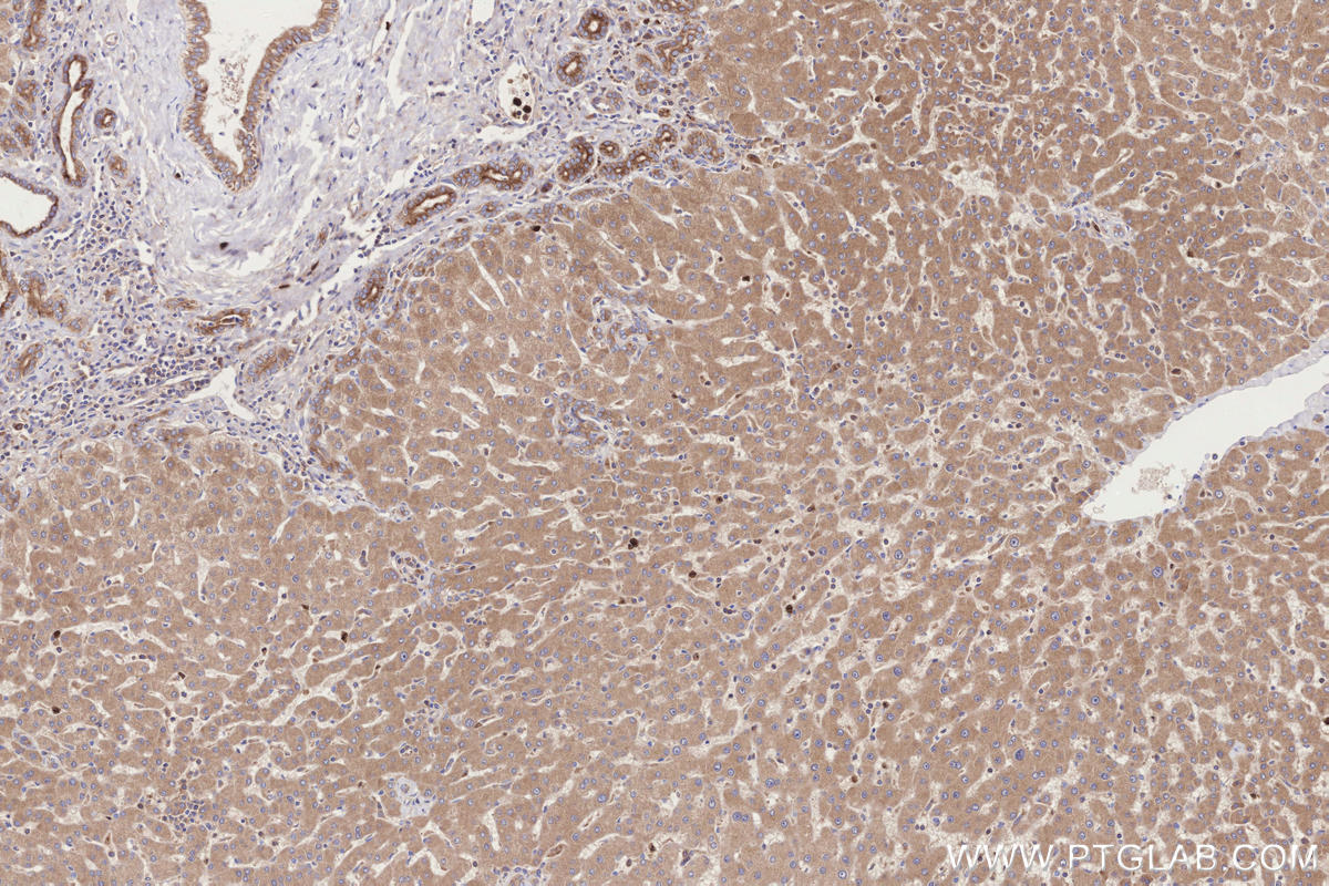 Immunohistochemical analysis of paraffin-embedded human hepatocirrhosis tissue slide using KHC3305 (MRPS27 IHC Kit).