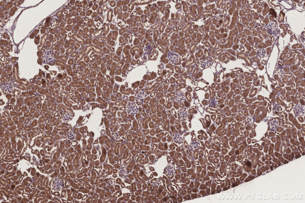 Immunohistochemical analysis of paraffin-embedded mouse kidney tissue slide using KHC3306 (MRPS31 IHC Kit). Immunohistochemical analysis of paraffin-embedded mouse kidney tissue slide using KHC3306 (MRPS31 IHC Kit).
