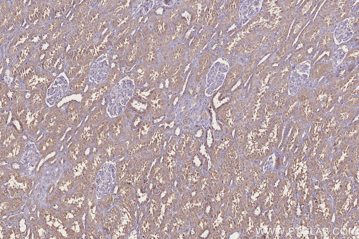 Immunohistochemical analysis of paraffin-embedded human kidney tissue slide using KHC3306 (MRPS31 IHC Kit). Immunohistochemical analysis of paraffin-embedded human kidney tissue slide using KHC3306 (MRPS31 IHC Kit).