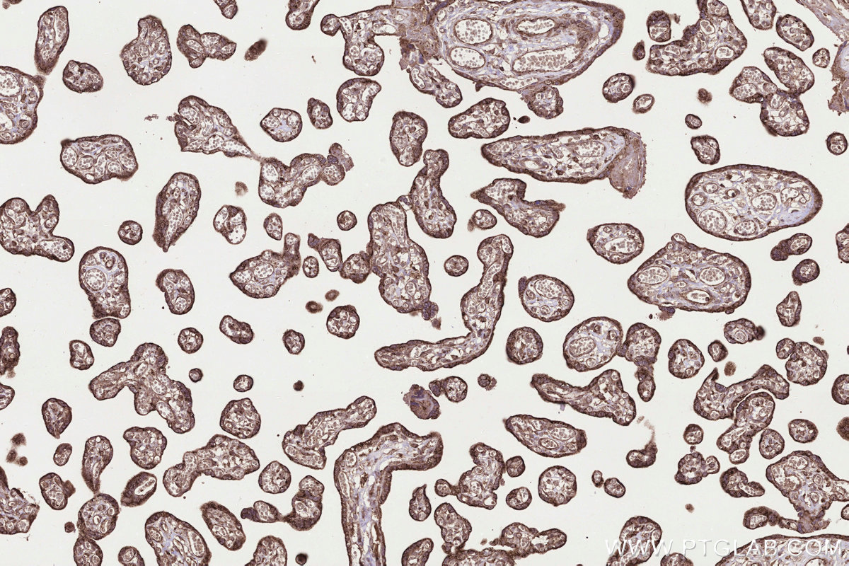 Immunohistochemical analysis of paraffin-embedded human placenta tissue slide using KHC3306 (MRPS31 IHC Kit). Immunohistochemical analysis of paraffin-embedded human placenta tissue slide using KHC3306 (MRPS31 IHC Kit).
