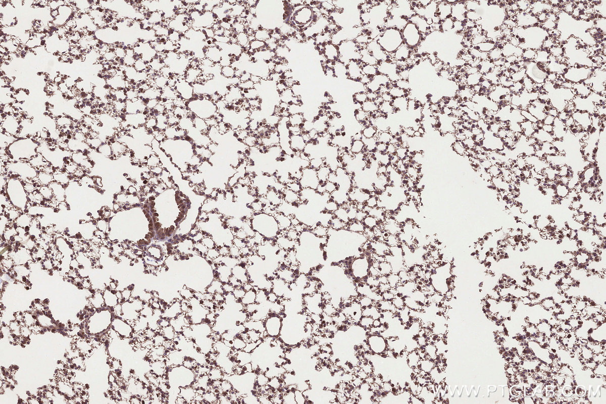 Immunohistochemical analysis of paraffin-embedded mouse lung tissue slide using KHC3306 (MRPS31 IHC Kit). Immunohistochemical analysis of paraffin-embedded mouse lung tissue slide using KHC3306 (MRPS31 IHC Kit).