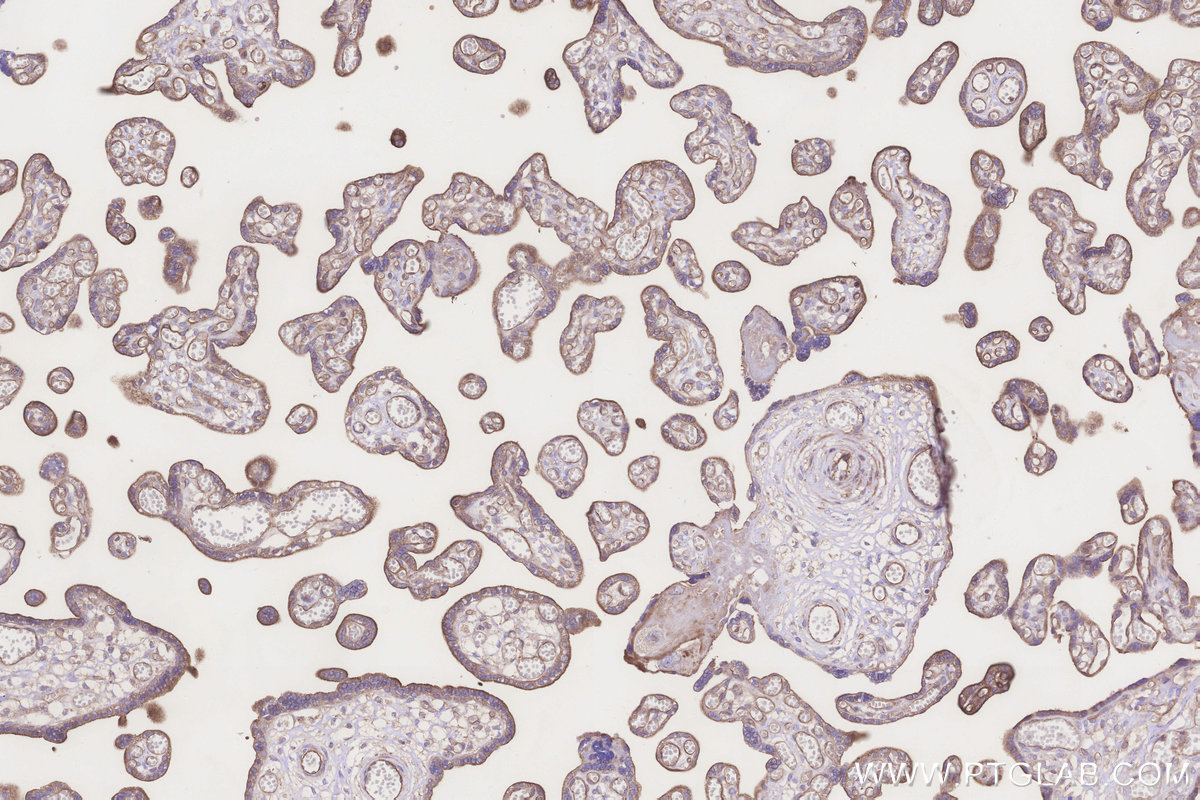 Immunohistochemical analysis of paraffin-embedded human placenta tissue slide using KHC3241 (MRPS6 IHC Kit).