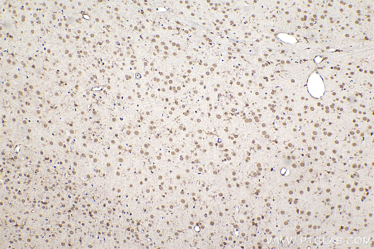 Immunohistochemical analysis of paraffin-embedded mouse brain tissue slide using KHC1211 (MSI1 IHC Kit).