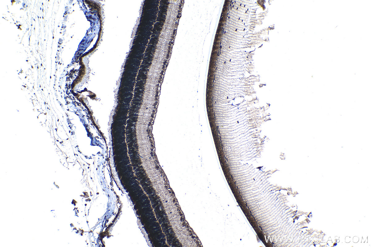 Immunohistochemical analysis of paraffin-embedded mouse eye tissue slide using KHC1211 (MSI1 IHC Kit).