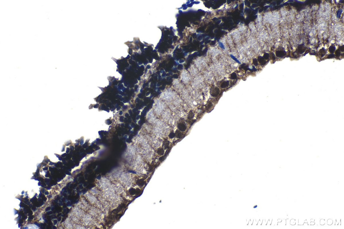 Immunohistochemical analysis of paraffin-embedded rat eye tissue slide using KHC1211 (MSI1 IHC Kit).