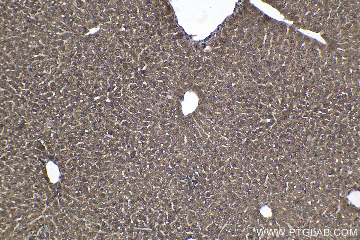 Immunohistochemical analysis of paraffin-embedded mouse liver tissue slide using KHC1014 (MSI2 IHC Kit).