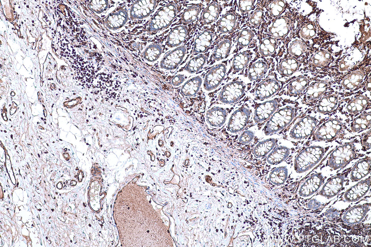 Immunohistochemical analysis of paraffin-embedded human colon tissue slide using KHC0664 (MSN IHC Kit).