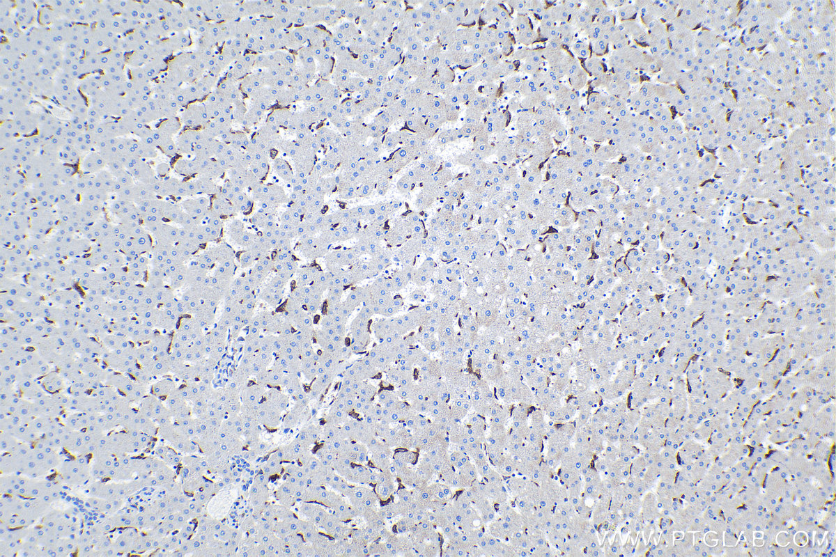 Immunohistochemical analysis of paraffin-embedded human liver tissue slide using KHC1138 (MSR1 IHC Kit).