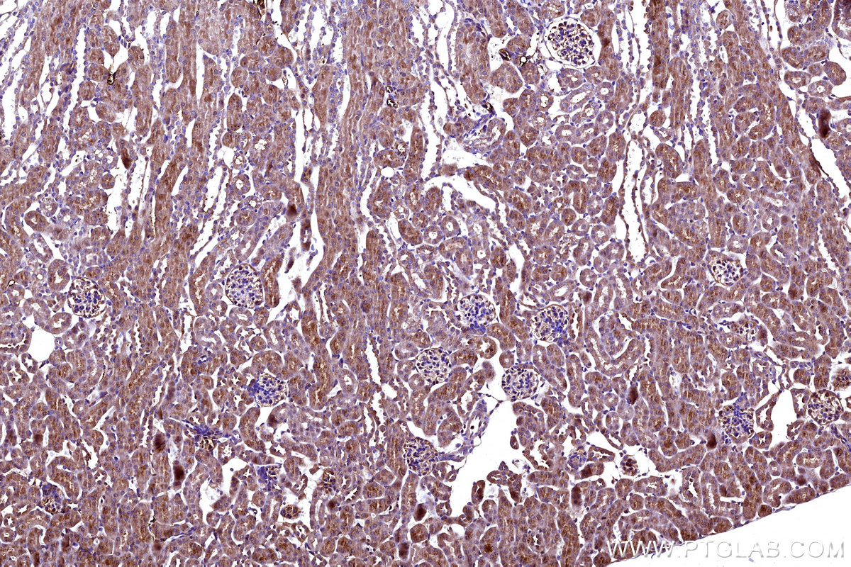 Immunohistochemical analysis of paraffin-embedded mouse kidney tissue slide using KHC3165 (MT-ND5 IHC Kit).