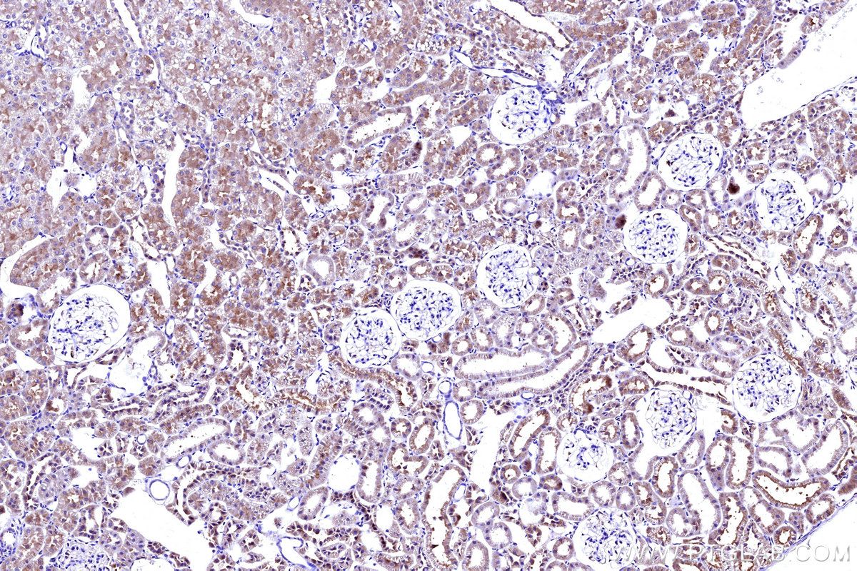 Immunohistochemical analysis of paraffin-embedded rat kidney tissue slide using KHC3165 (MT-ND5 IHC Kit).