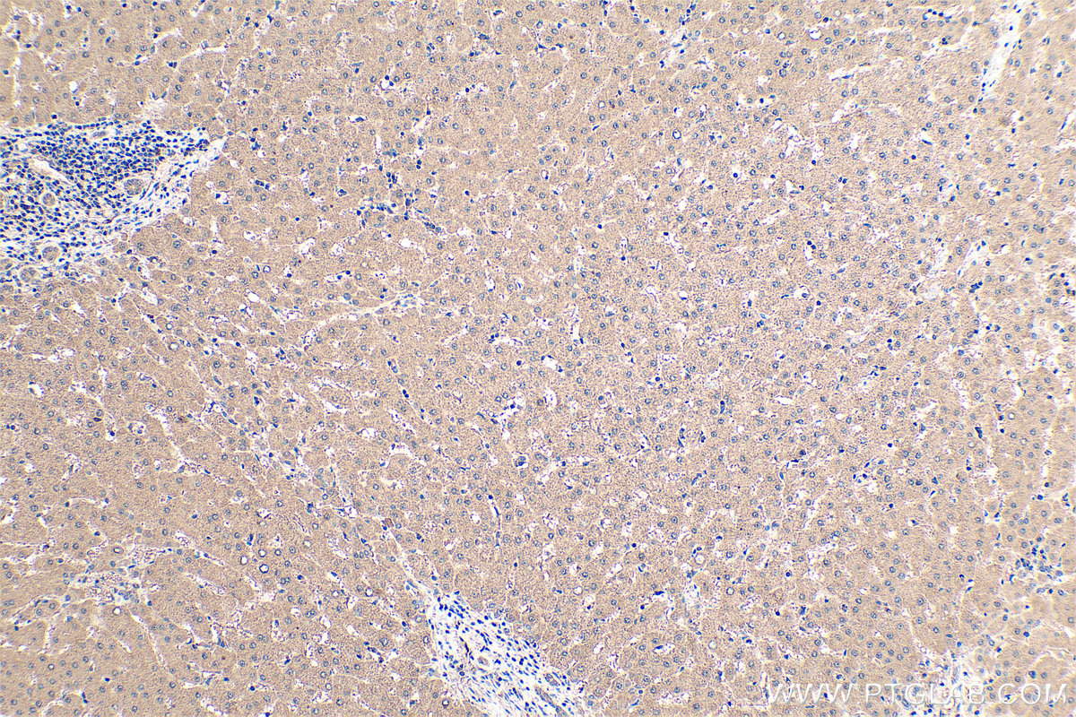 Immunohistochemical analysis of paraffin-embedded human liver tissue slide using KHC0438 (MT2A IHC Kit).