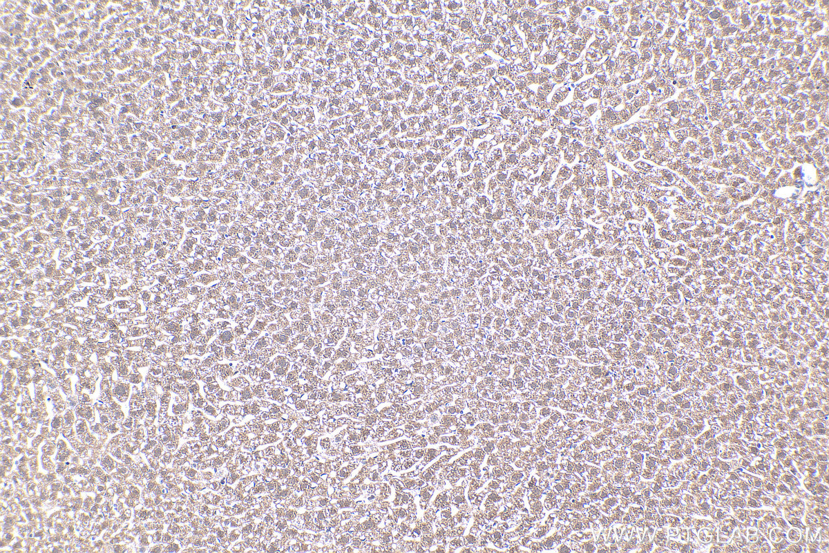 Immunohistochemical analysis of paraffin-embedded mouse liver tissue slide using KHC0438 (MT2A IHC Kit).