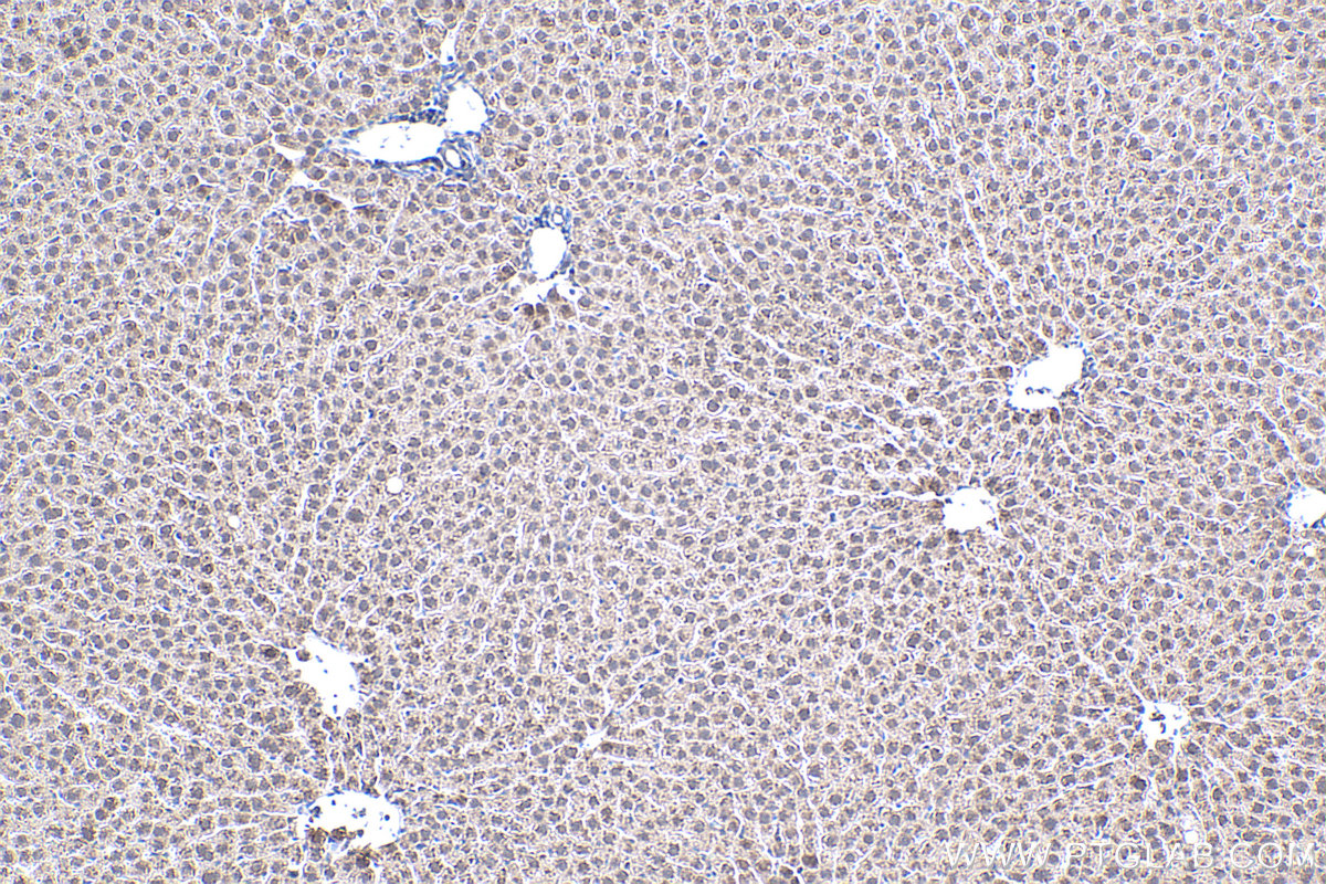 Immunohistochemical analysis of paraffin-embedded rat liver tissue slide using KHC0438 (MT2A IHC Kit).