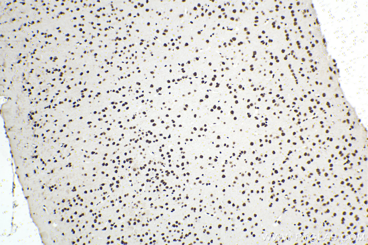 Immunohistochemical analysis of paraffin-embedded mouse brain tissue slide using KHC1481 (MTA2 IHC Kit).