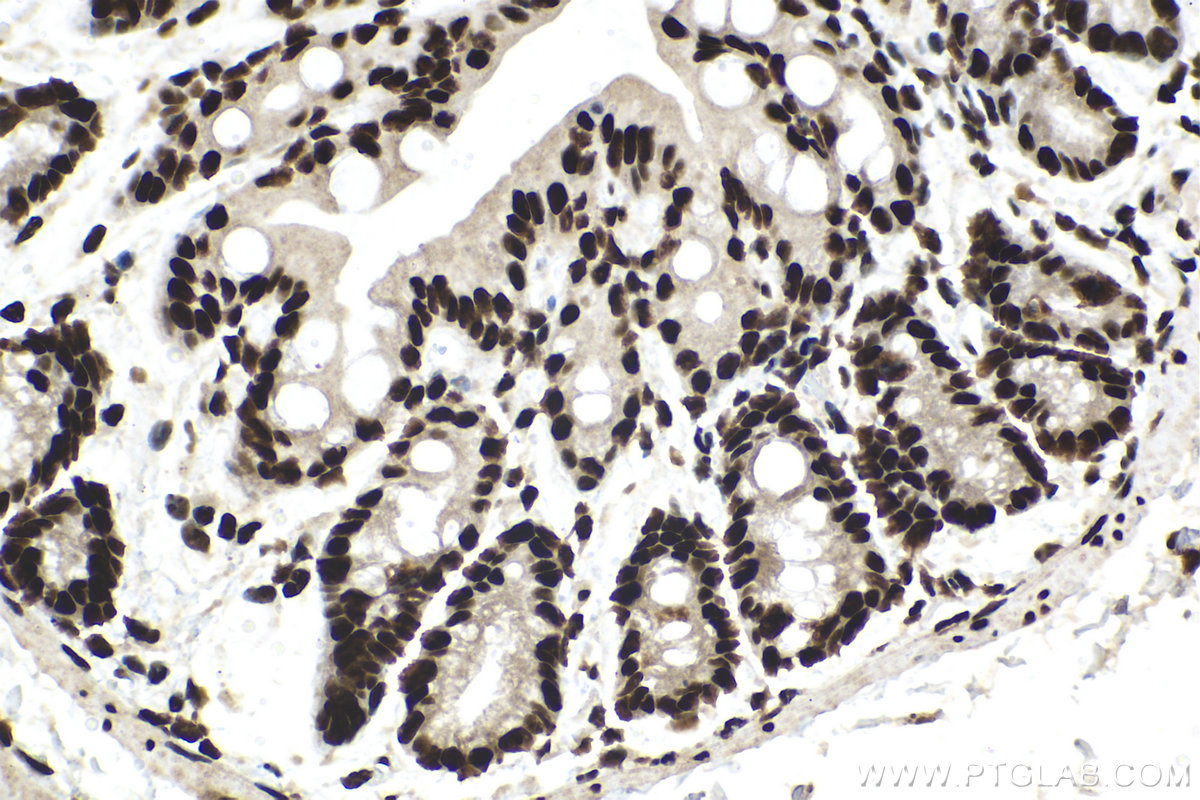 Immunohistochemical analysis of paraffin-embedded mouse colon tissue slide using KHC1481 (MTA2 IHC Kit).