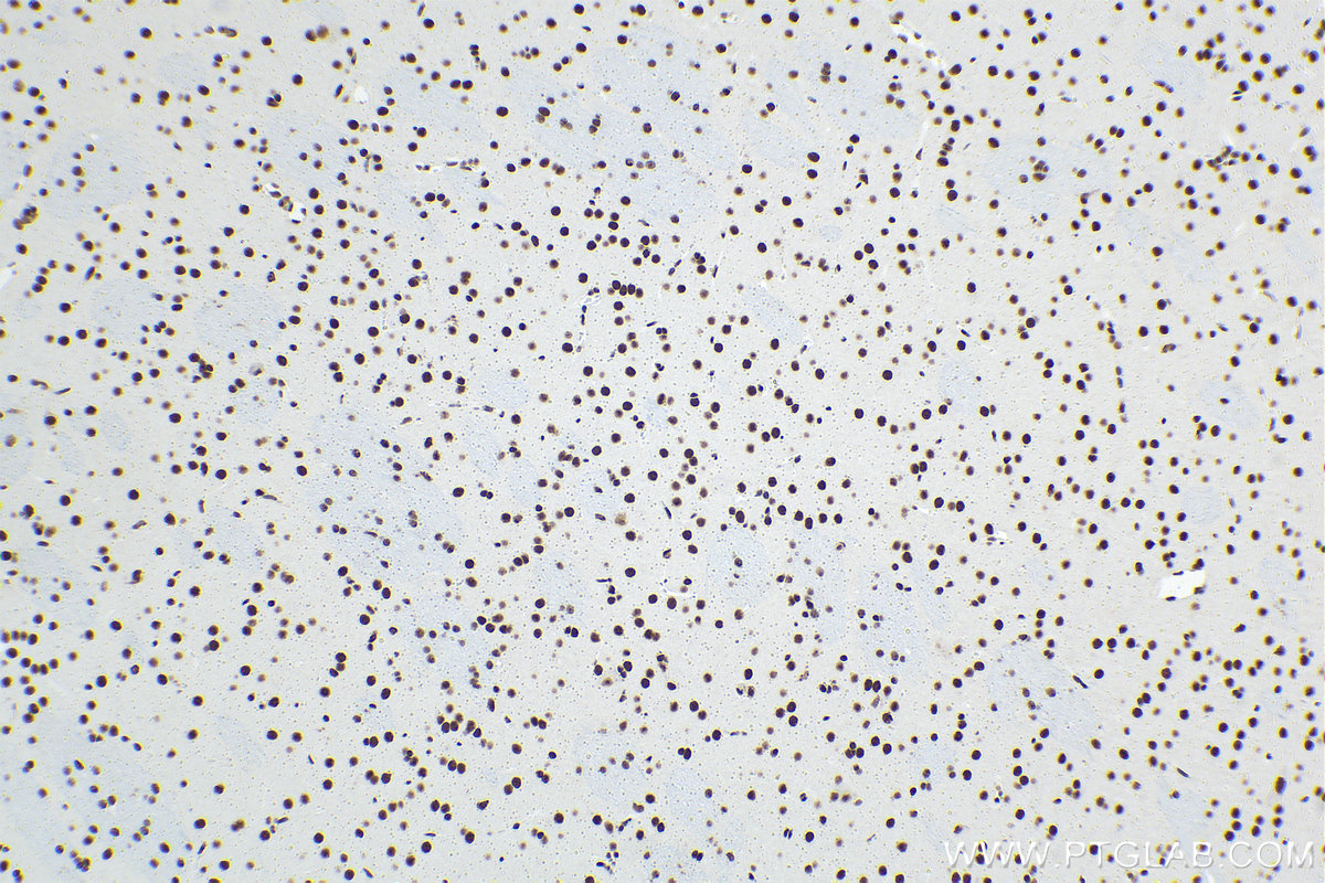 Immunohistochemical analysis of paraffin-embedded rat brain tissue slide using KHC1481 (MTA2 IHC Kit).