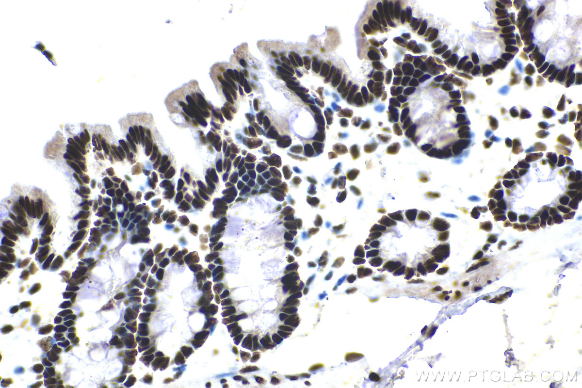 Immunohistochemical analysis of paraffin-embedded rat colon tissue slide using KHC1481 (MTA2 IHC Kit).